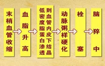 打呼嚕危害_多普勒檢查_多普勒廠家.jpg 打呼嚕危害_多普勒檢查_多普勒廠家.jpg