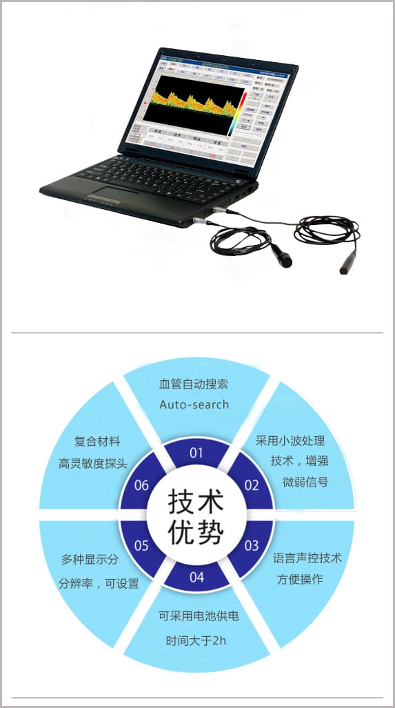 便攜式經(jīng)顱多普勒技術(shù)優(yōu)勢_TCD儀.jpg 便攜式經(jīng)顱多普勒技術(shù)優(yōu)勢_TCD儀.jpg