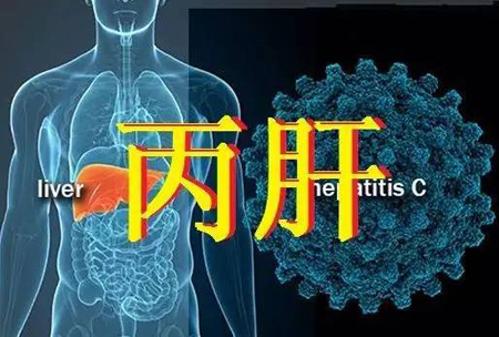 丙肝 丙肝